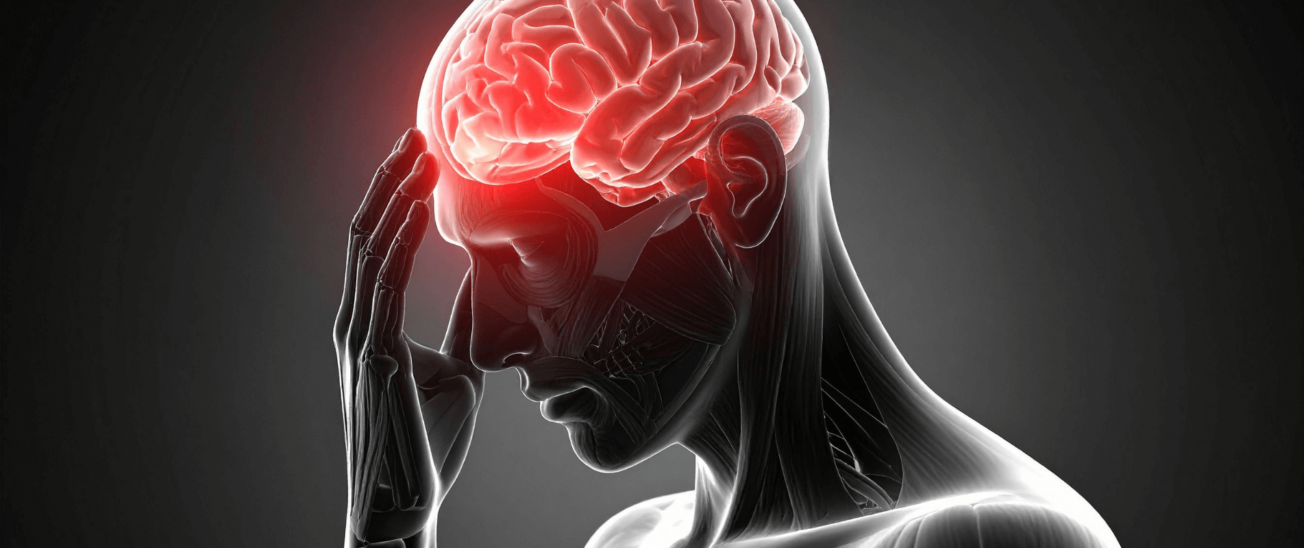 cervicogen headache