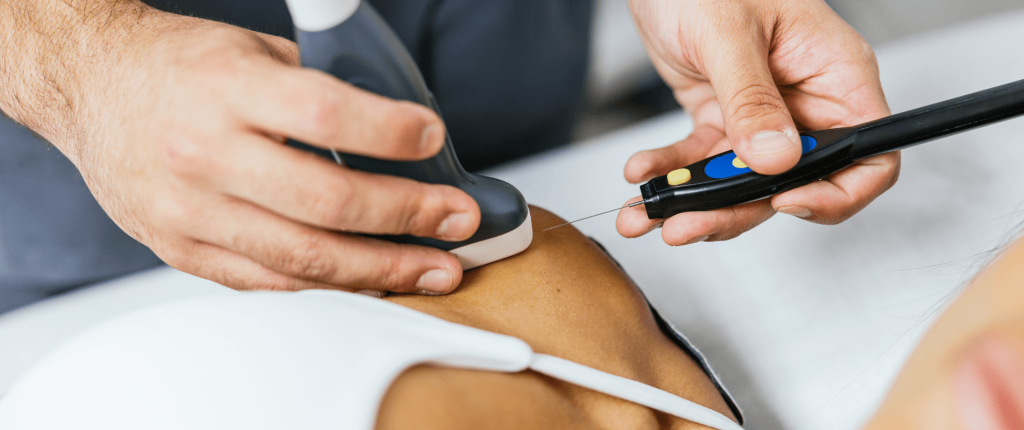 Infiltrațiile ecoghidate și ecografiile musculo-scheletale 2 Ultrasound guide 1